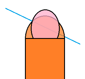 .png